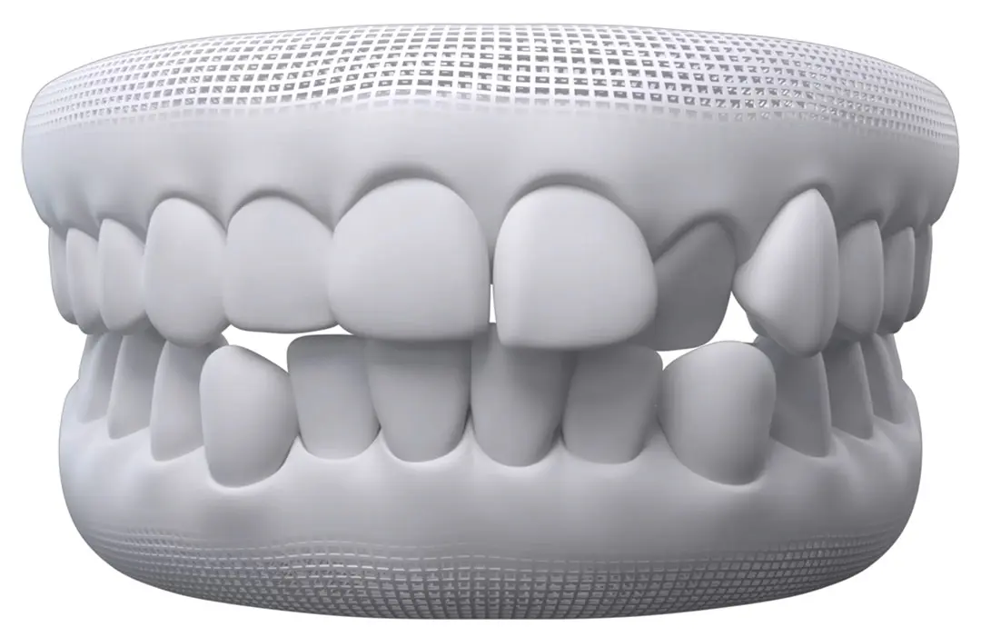 Generally Straighter Teeth